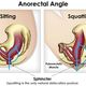 Image for article titled You've Been Pooping All Wrong